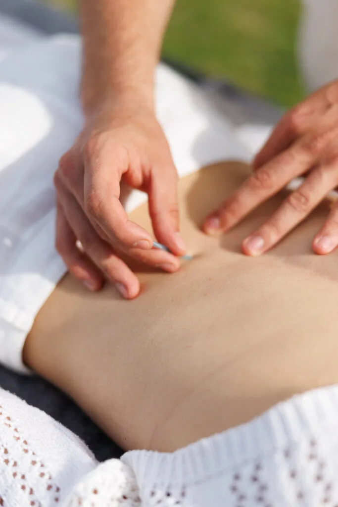 dry needling treatment in milos physiotherapy session